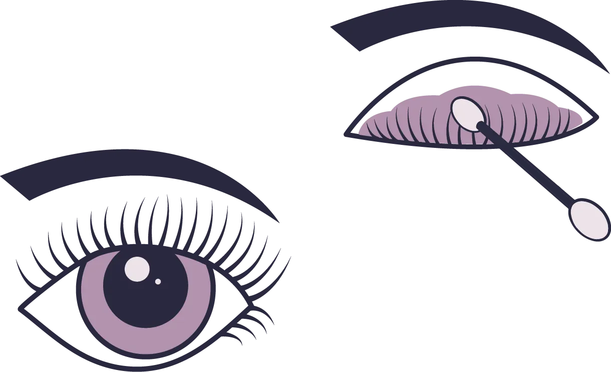 illustration protocole 2