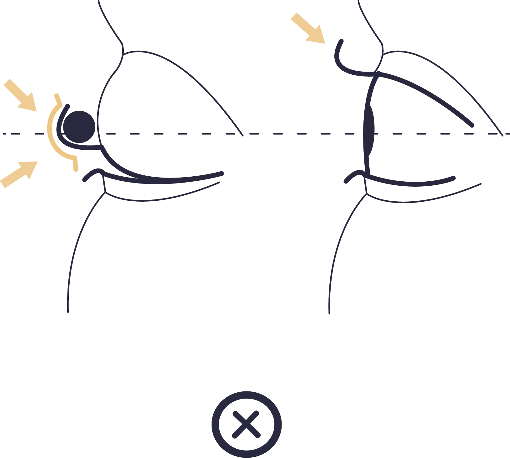 illustration mauvais placement