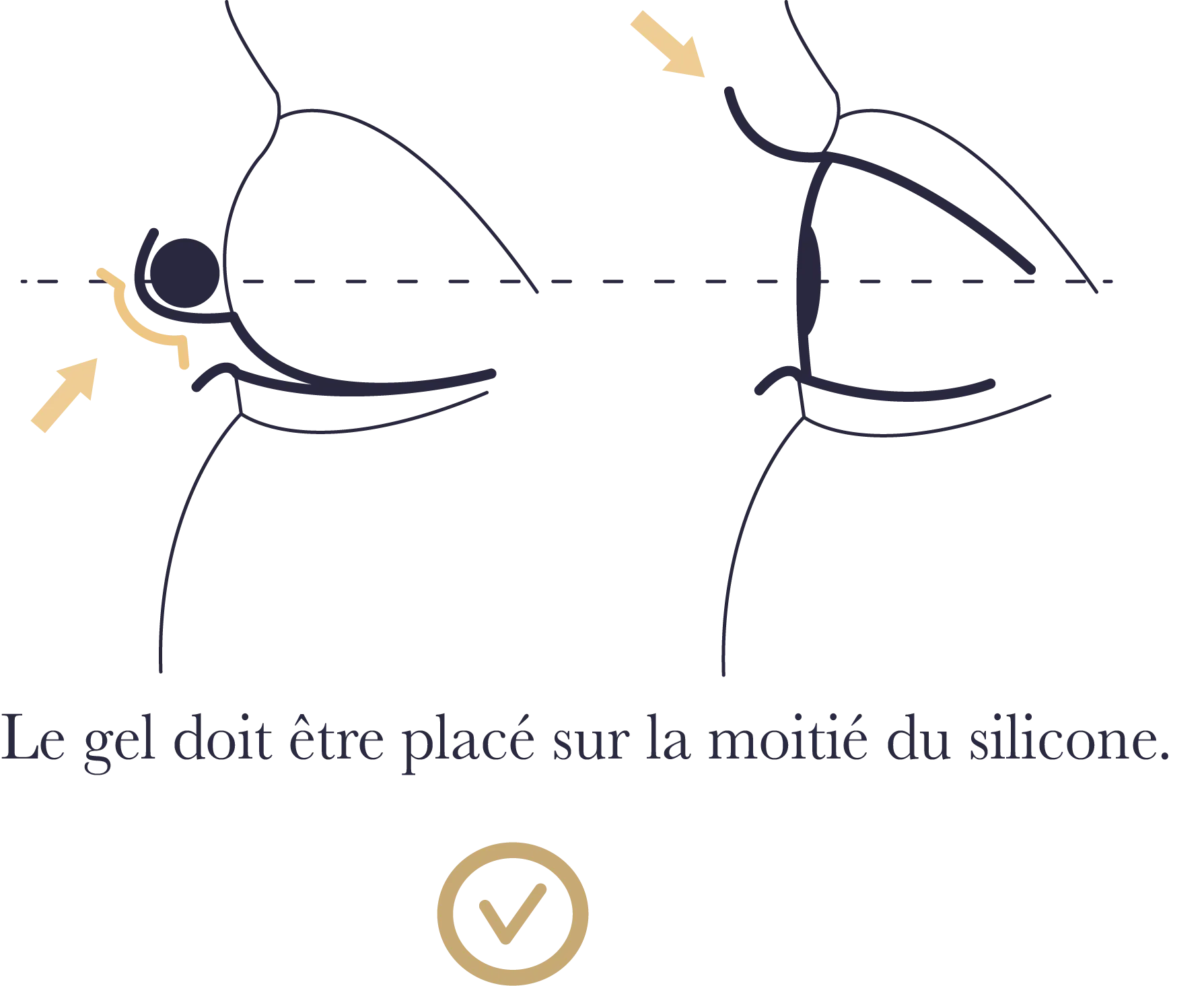 illustration bon placement