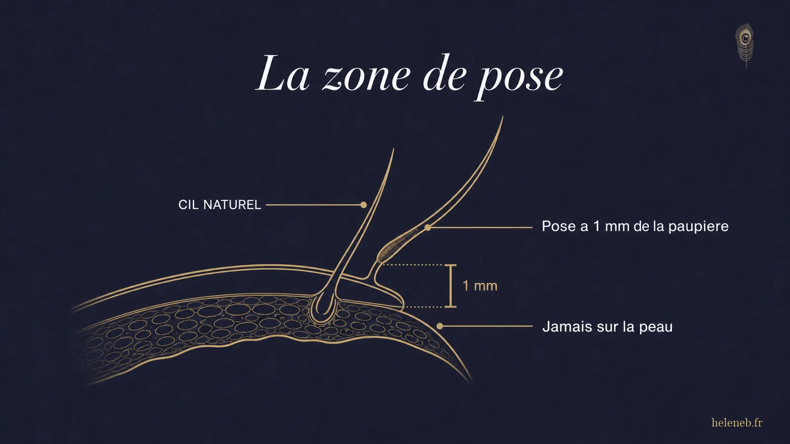 La zone de pose